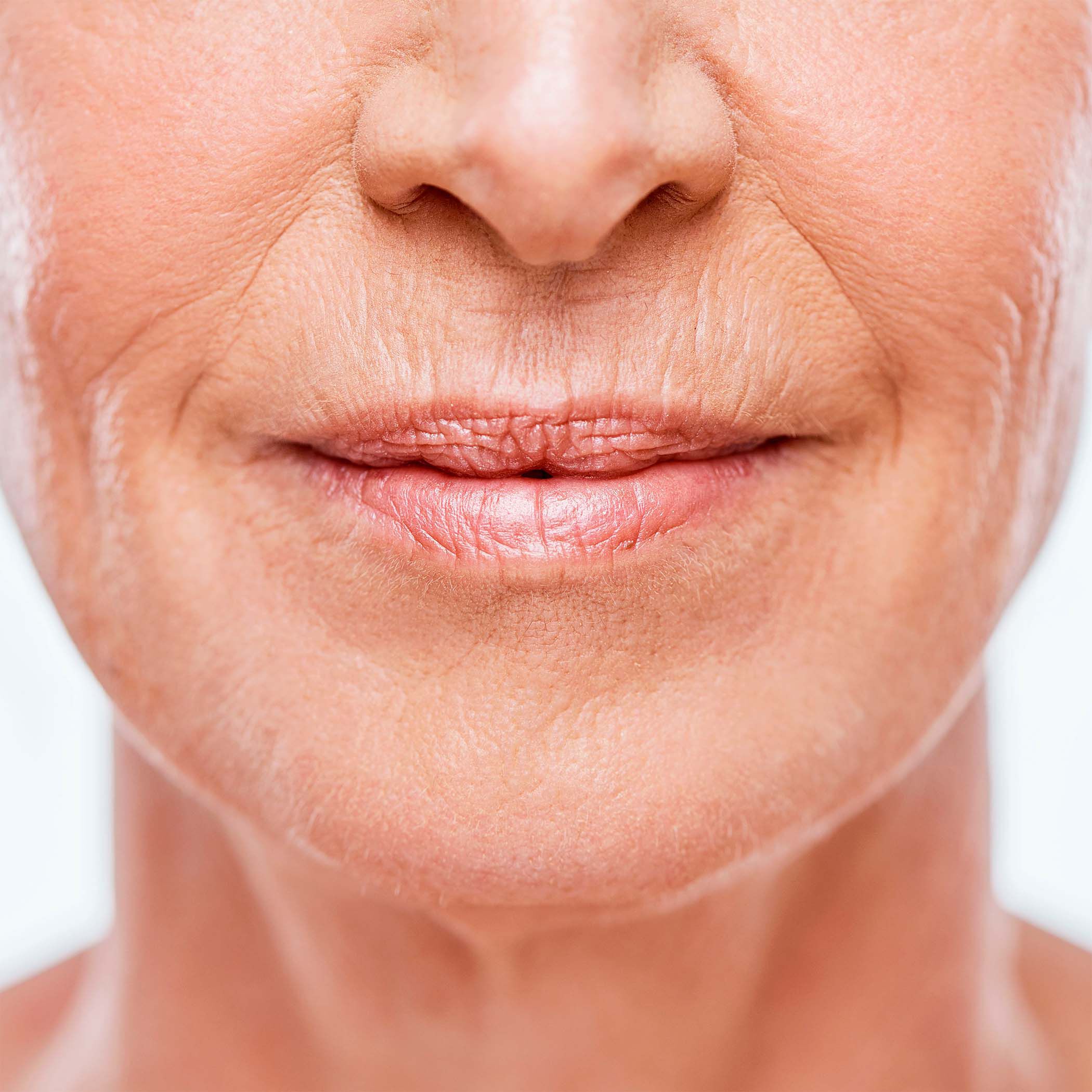 Zmarszczki marionetki, palacza i bruzdy nosowo-wargowe – jak rozpoznać zmarszczki wokoł ust i jaką wybrać pielęgnację przeciwzmarszczkową?