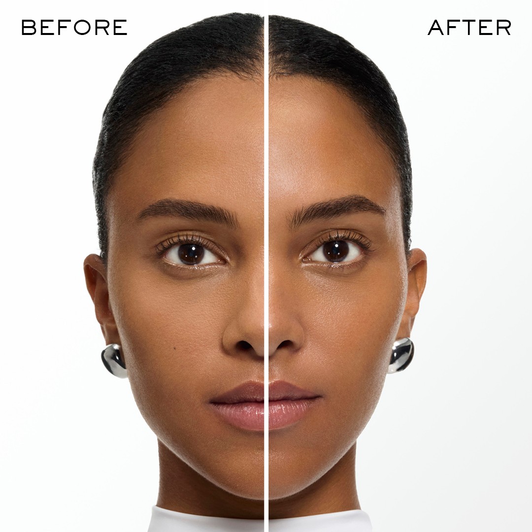 before after